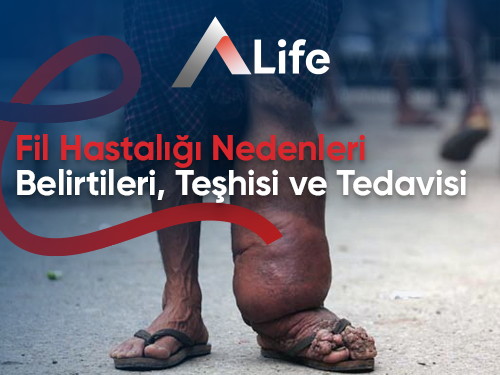 Fil Hastalığı: Nedenler, Belirtiler & Tedavi